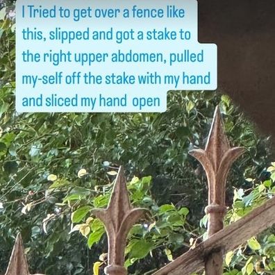 Isabelle Cornish reveals stake fence injury