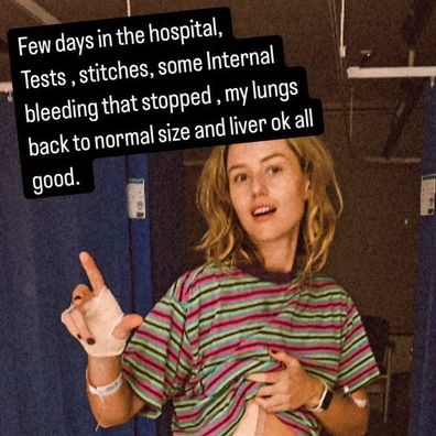 Isabelle Cornish reveals stake fence injury