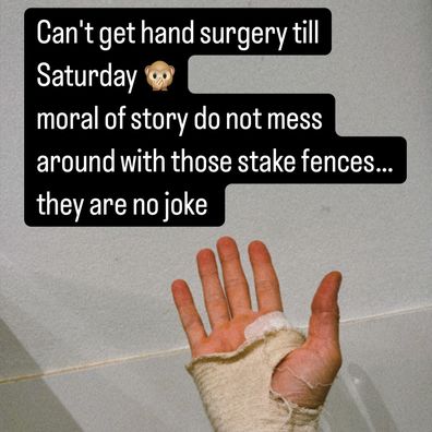 Isabelle Cornish reveals stake fence injury