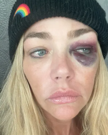 Denise Richards Granted Restraining Order After Allegedly Being Choked, Abused and Threatened by Estranged Husband 7 Denise Richards Granted Restraining Order After Allegedly Being Choked, Abused and Threatened by Estranged Husband