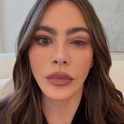 Sofia Vergara eye infection emmys 2025